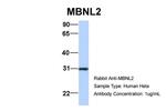 MBNL2 Antibody in Western Blot (WB)