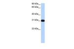 MBNL2 Antibody in Western Blot (WB)