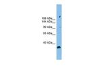 PACS2 Polyclonal Antibody