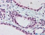 FUBP3 Antibody in Immunohistochemistry (IHC)
