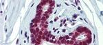 FUBP3 Antibody in Immunohistochemistry (IHC)