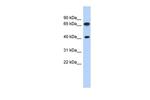 FUBP3 Antibody in Western Blot (WB)