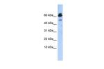 ABAT Polyclonal Antibody
