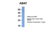 ABAT Polyclonal Antibody