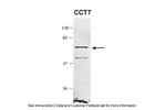 TCP-1 eta Polyclonal Antibody