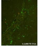CHI3L1 Polyclonal Antibody