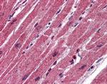 CPN1 Antibody in Immunohistochemistry (IHC)