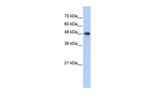 CPN1 Antibody in Western Blot (WB)