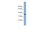CRYM Polyclonal Antibody