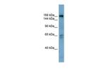 DOCK2 Polyclonal Antibody