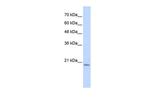 PFDN6 Antibody in Western Blot (WB)