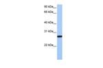 ECT2 Polyclonal Antibody