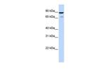 HIPK4 Polyclonal Antibody