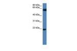 FBXO32 Polyclonal Antibody