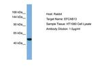 EFCAB13 Antibody in Western Blot (WB)