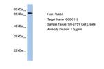 CCDC116 Polyclonal Antibody
