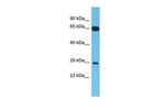 FAM227B Polyclonal Antibody
