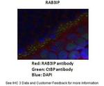 RAB3IP Antibody in Immunohistochemistry (IHC)