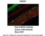 RAB3IP Antibody in Immunohistochemistry (IHC)