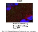 RAB3IP Polyclonal Antibody