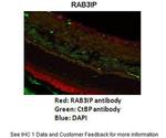 RAB3IP Polyclonal Antibody