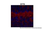Synaptotagmin 9 Antibody in Immunohistochemistry (IHC)