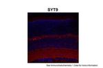 Synaptotagmin 9 Antibody in Immunohistochemistry (IHC)