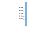 CHCHD1 Polyclonal Antibody