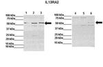 IL13RA2 Polyclonal Antibody