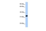 Acrosomal Vesicle Protein Polyclonal Antibody