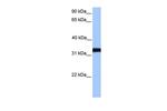 LDHC Polyclonal Antibody
