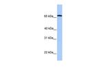CCIN Polyclonal Antibody