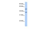 ST6GALNAC2 Polyclonal Antibody