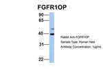 FGFR1OP Antibody in Western Blot (WB)