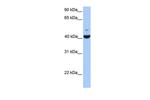 FGFR1OP Antibody in Western Blot (WB)