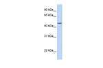 TBL2 Polyclonal Antibody