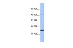 SPAG11B Polyclonal Antibody