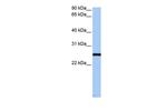CEP112 Polyclonal Antibody
