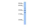 ZC3H14 Polyclonal Antibody