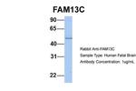 FAM13C Antibody in Western Blot (WB)