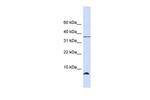 HSPE1 Polyclonal Antibody