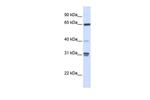 GBP2 Polyclonal Antibody