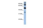 INPP5B Polyclonal Antibody