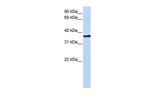 CHORDC1 Polyclonal Antibody