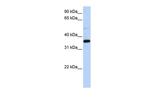 PTGR1 Polyclonal Antibody