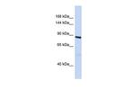 HMHA1 Polyclonal Antibody