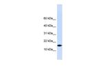 PHLDA3 Polyclonal Antibody
