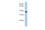 SPO11 Polyclonal Antibody