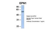 Epsin 1 Polyclonal Antibody