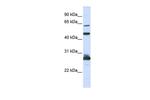 PES1 Antibody in Western Blot (WB)